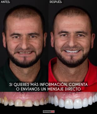 Slider image (2) Odontologia Laser