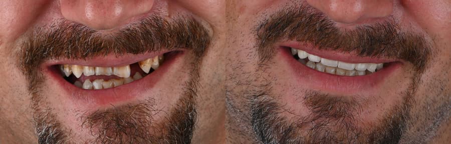 Slider image (2) Dentleon Polyclinics