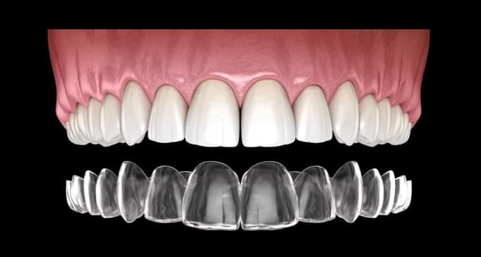 Slider image (2) Dental Life by Nucleo Medico Riviera