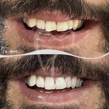 Slider image (2) A-Dent Dental Clinic in Antalya, Turkey