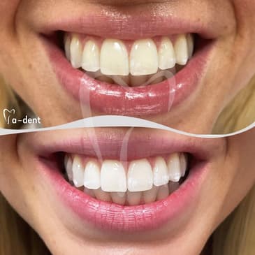 Slider image (4) A-Dent Dental Clinic in Antalya, Turkey