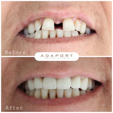 Slider image (4) Adaport Dental Clinic