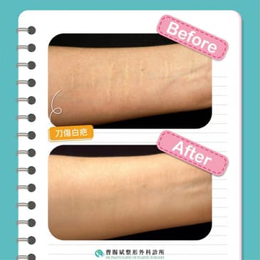 Slider image (4) Dr. Tsao Clinic of Plastic Surgery