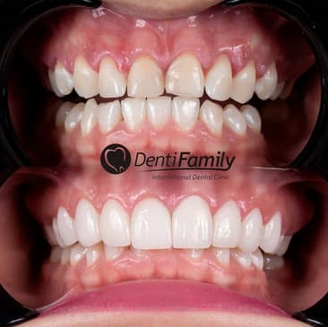 Slider image (6) DENTIFAMILY