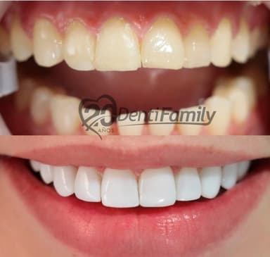 Slider image (7) DENTIFAMILY