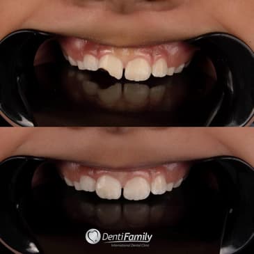 Slider image (8) DENTIFAMILY