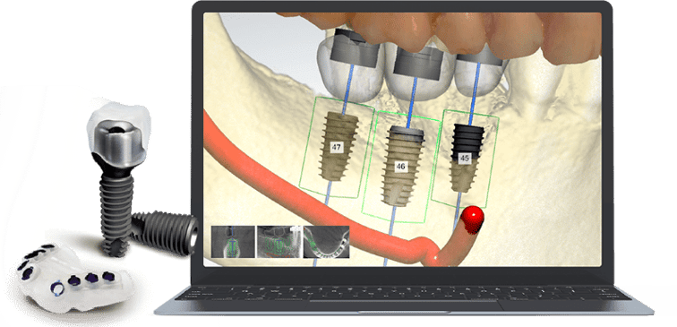 Slider image (5) Seoul Today Dental Clinic | Goyang, South Korea
