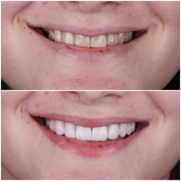 Slider image (1) Odonto Liuzzi - Dental Clinic in Rio de Janeiro, Brazil