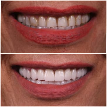 Slider image (2) Odonto Liuzzi - Dental Clinic in Rio de Janeiro, Brazil