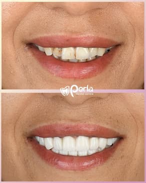 Slider image (1) Perla Dental Centre