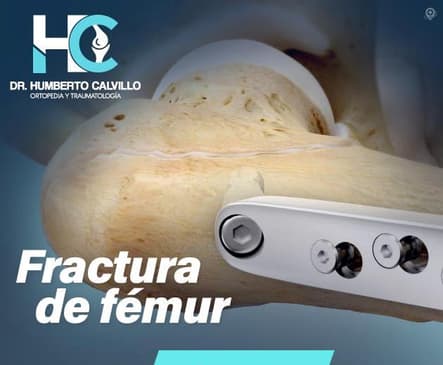 Slider image (2) Dr. Humberto Calvillo Jimenez - Orthopedic Surgery in Puerto Vallarta