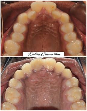 Slider image (3) FMS International Dental Center