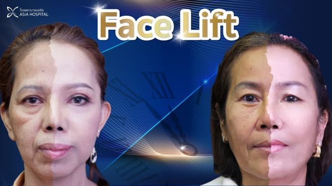 Slider image (7) Asia Cosmetic Hospital