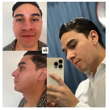 Slider image (1) Dr. Israel Villalobos - Plastic Surgery in Tijuana Mexico