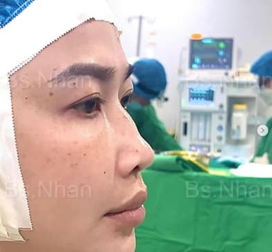 Slider image (6) Dr. Nhan Ho Aesthetics and Plastic Surgery