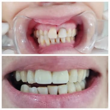 Slider image (6) Prestij Dental Clinic