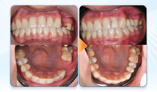 Slider image (7) Dr. Care Implant Clinic