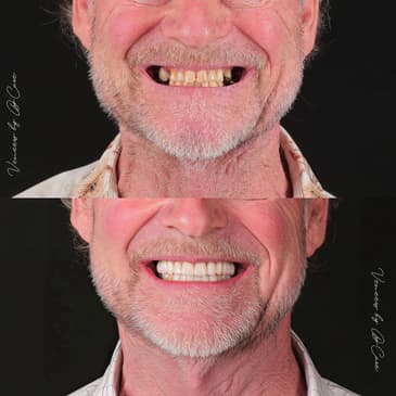 Slider image (1) Dr. Care Implant Clinic