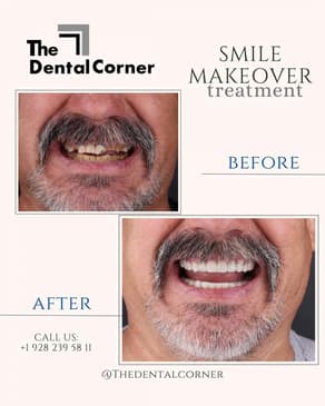 Slider image (9) The Dental Corner