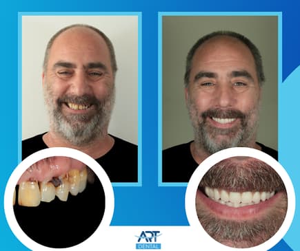 Slider image (2) Art Dental Care