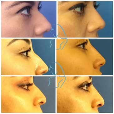 Slider image (4) Dr. Xavier Toscano - Plastic Surgeon