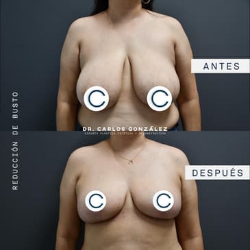 Slider image (3) Dr. Carlos Gonzalez Alvarado