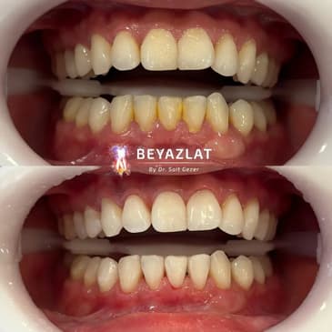 Slider image (8) Dr. Sait Gezer
