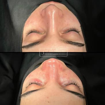 Slider image (1) Dr. Kemal Uslu Clinic