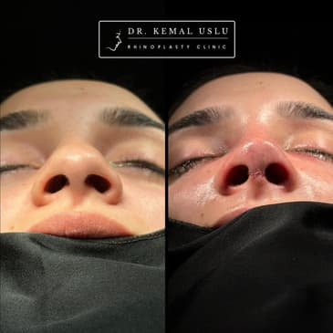 Slider image (2) Dr. Kemal Uslu Clinic