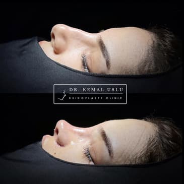 Slider image (3) Dr. Kemal Uslu Clinic
