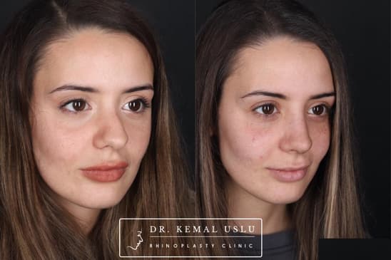 Slider image (4) Dr. Kemal Uslu Clinic
