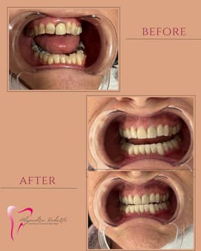 Slider image (8) Dr. Alejandra Rodarte Cosmetic & Implant Specialist