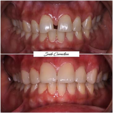 Slider image (4) FMS Dental Hospital - Kukatpally
