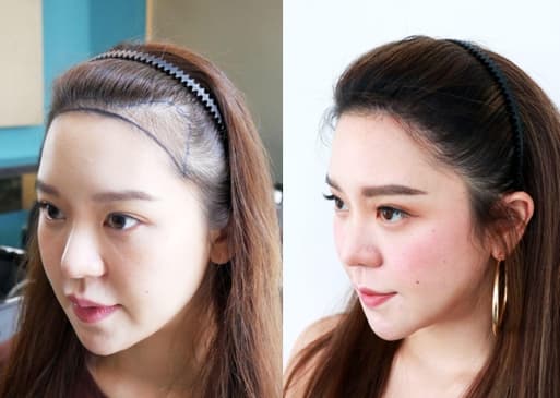 Slider image (7) The Best Medical Hair Center by Dr. Orn 