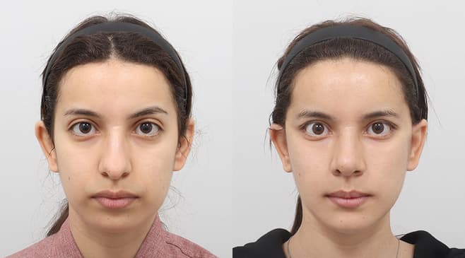 Slider image (3) AB Plastic Surgery