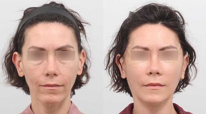 Slider image (6) AB Plastic Surgery