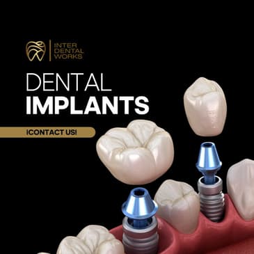 Slider image (2) Inter DentalWorks