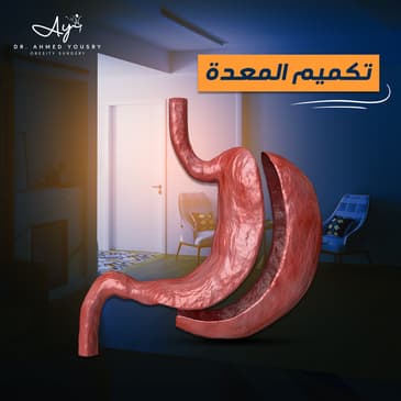 Slider image (5) Dr. Ahmed Yousry Clinic