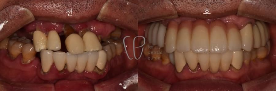 Slider image (2) Le Dental Clinic Restorative Cosmetic Dentistry Center