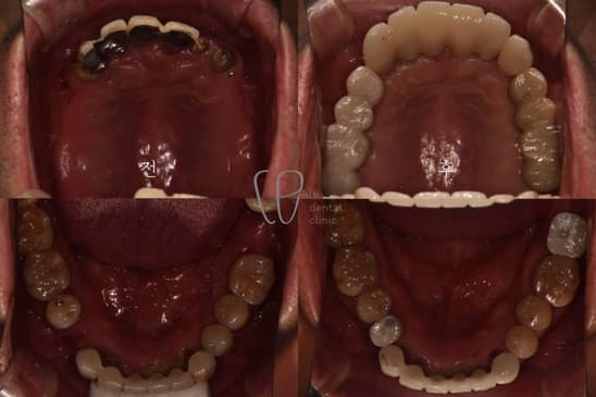 Slider image (3) Le Dental Clinic Restorative Cosmetic Dentistry Center
