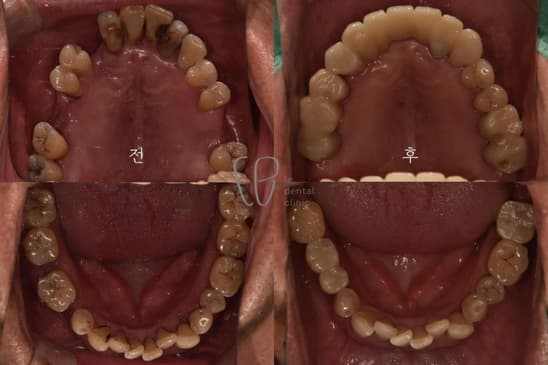 Slider image (4) Le Dental Clinic Restorative Cosmetic Dentistry Center