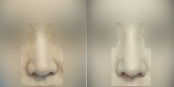 Slider image (5) MISOU Plastic Surgery Facial Contouring Beauty Clinic