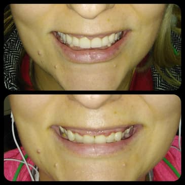 Slider image (5) Dr. Aleksandar Kovacevic - Dental Clinic in Croatia
