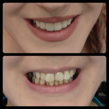 Slider image (10) Dr. Aleksandar Kovacevic - Dental Clinic in Croatia