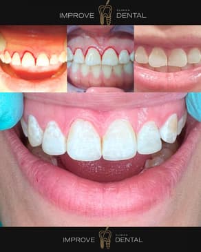 Slider image (6) Improve Dental