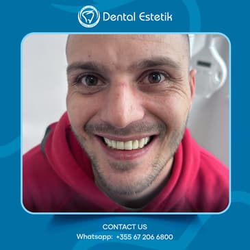 Slider image (1) Dental Estetik - Dental Clinic in Tirana, Albania