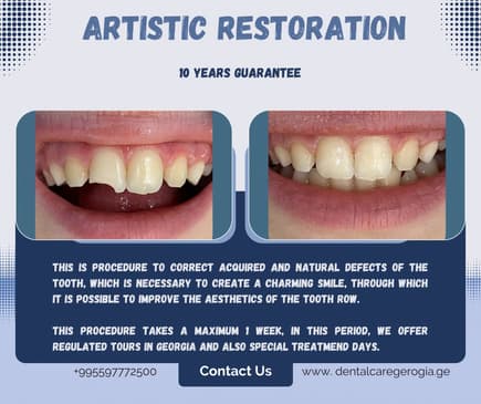 Slider image (2) Universe Dental - Best Dental Clinic in Tbilisi, Georgia