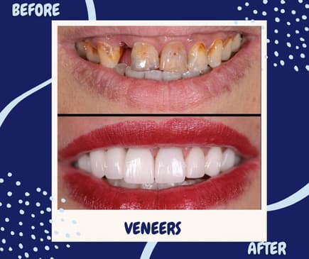 Slider image (4) Universe Dental - Best Dental Clinic in Tbilisi, Georgia