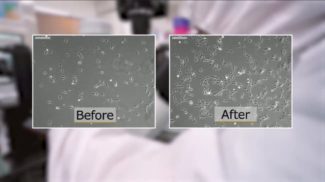 Slider image (8) HELENE  - Stem Cell Clinic