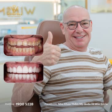 Slider image (4) WinSmile Dental Clinic Vietnam